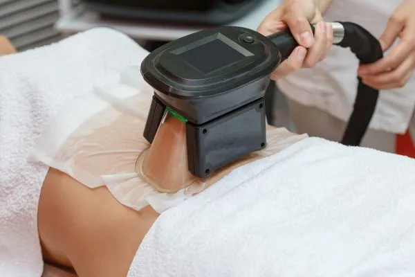 Image of person having fat freezing treatment to help weight gain Ravensthorpe