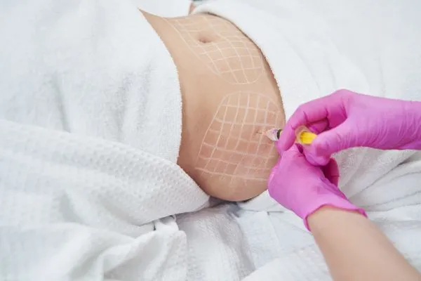 image of fat dissolving injections on love handles to help combat weight gain Ravensthorpe