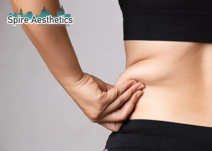 Image of woman pinching fat on their hips Ravensthorpe. Fat Freezing treatment