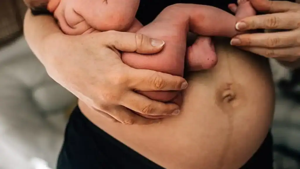 Why Is My Stomach Still Big After Pregnancy Ravensthorpe?